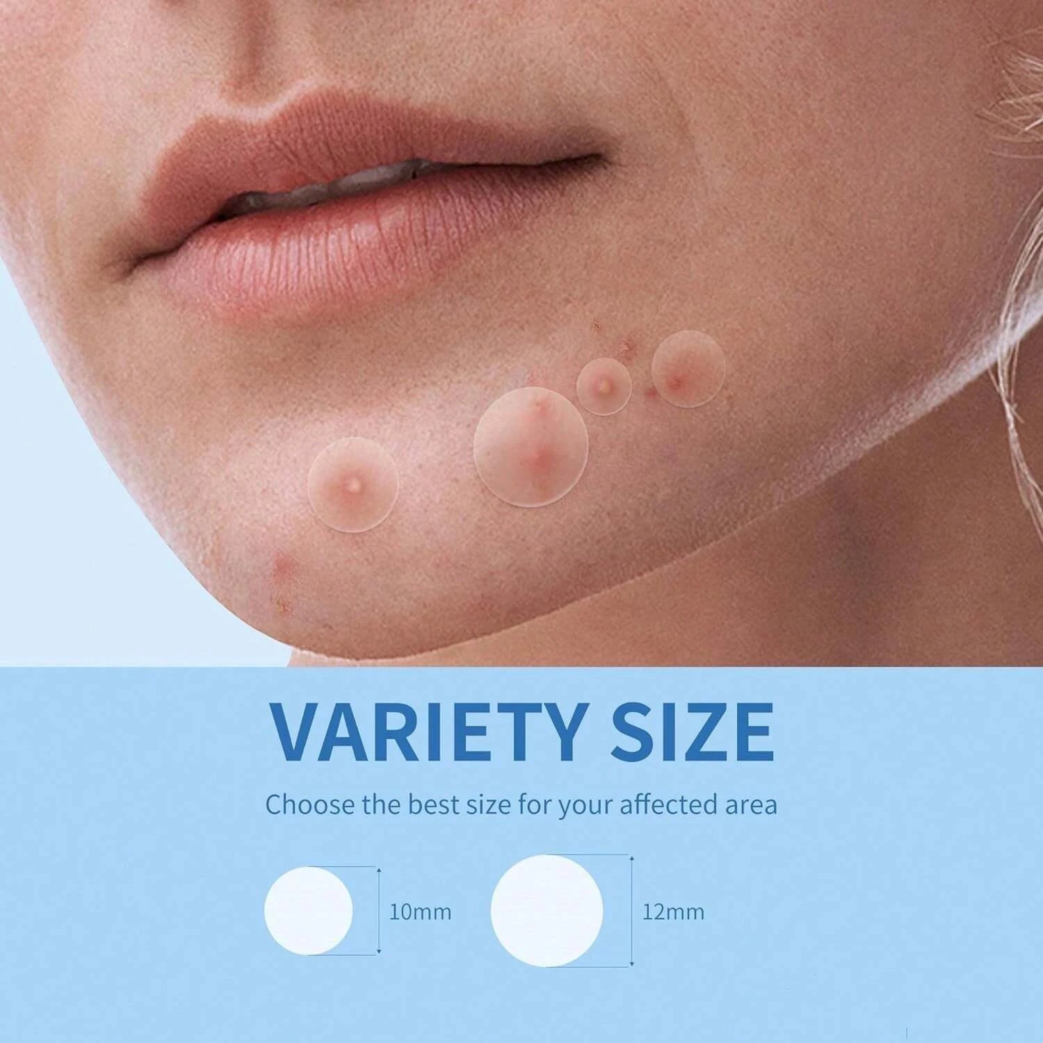 Gentle Non-Irritating Hydrocolloid Acne Patch